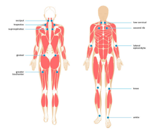 Myofascial Pain