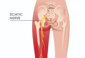 Sciatic nerve